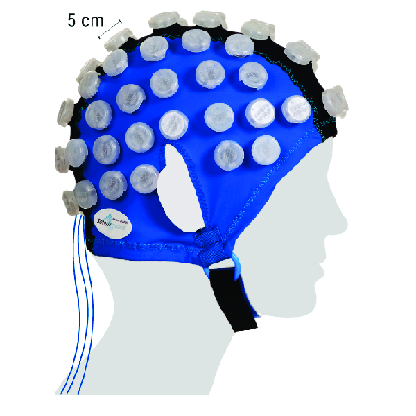 Neuromodulación en deporte